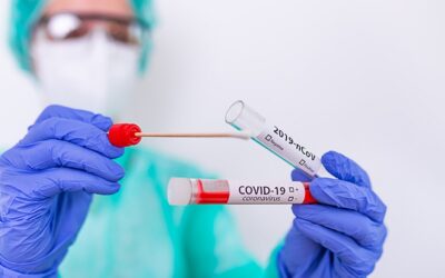 Testes de Covid-19 próximos de vencimento serão tema de Audiência Pública na Câmara